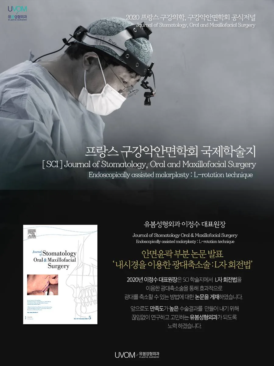 Endoscopically assisted malarplasty: L-rotation technique — source material