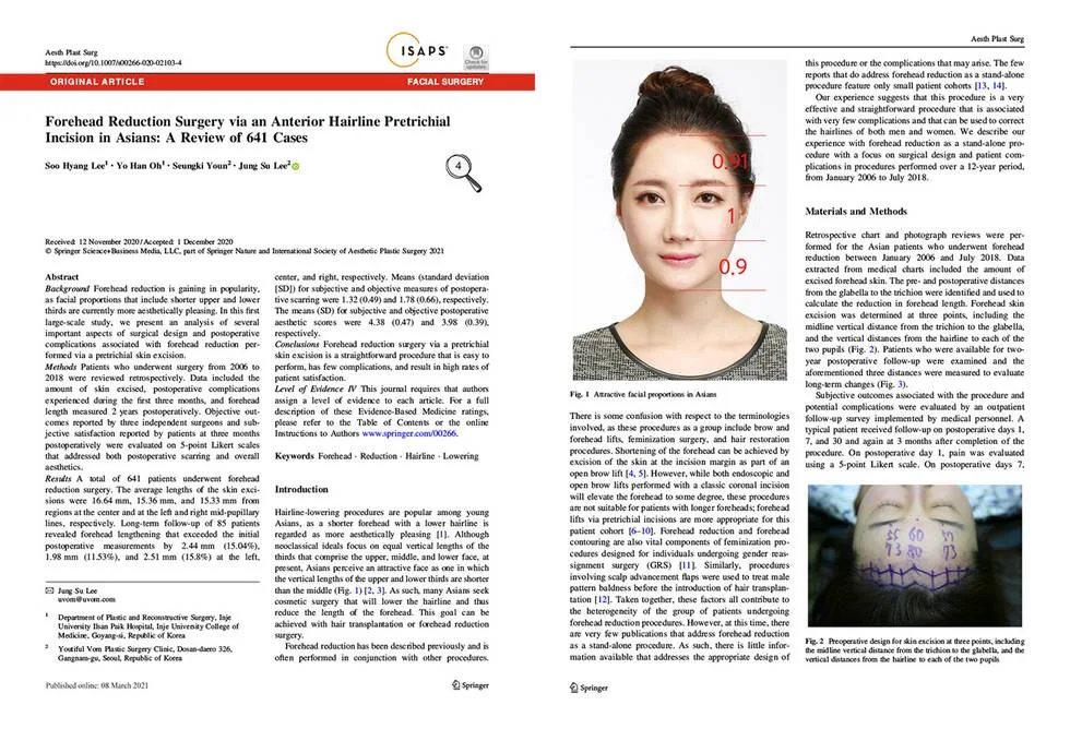Forehead reduction with a follicle-preserving incision in Asian patients: 641 cases — source material