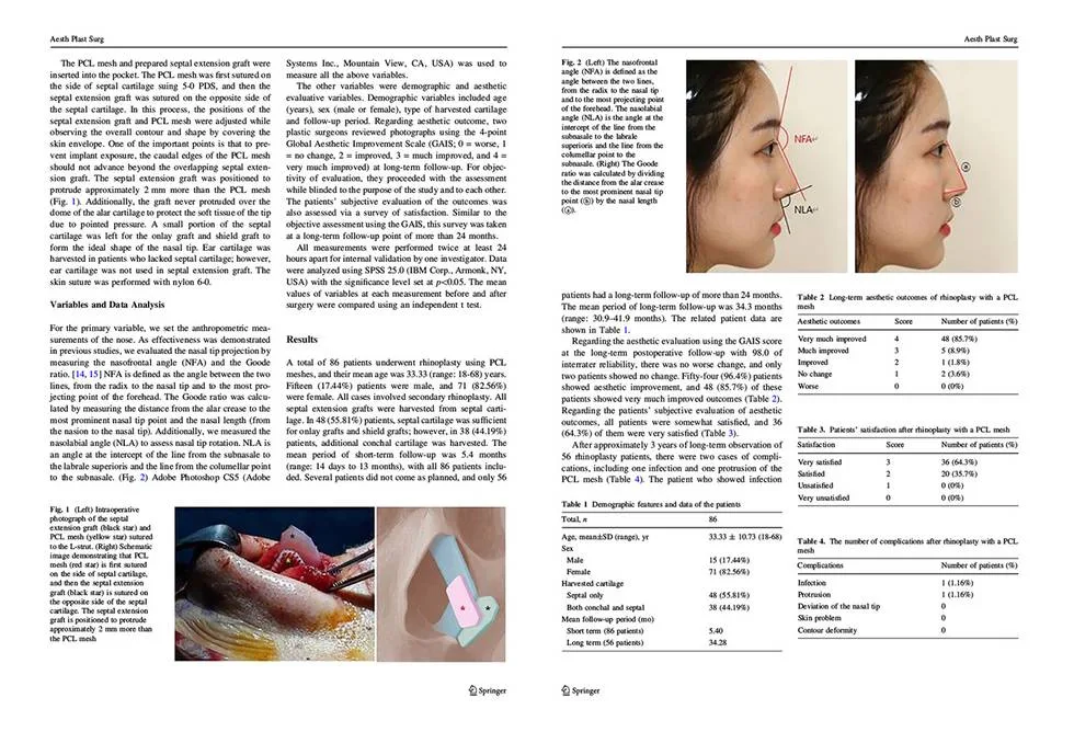 Long-term follow-up of nasal tip changes after PCL mesh degradation — source material