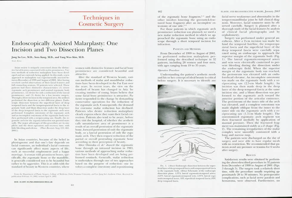 Zygoma reduction using the L-rotation technique — source material