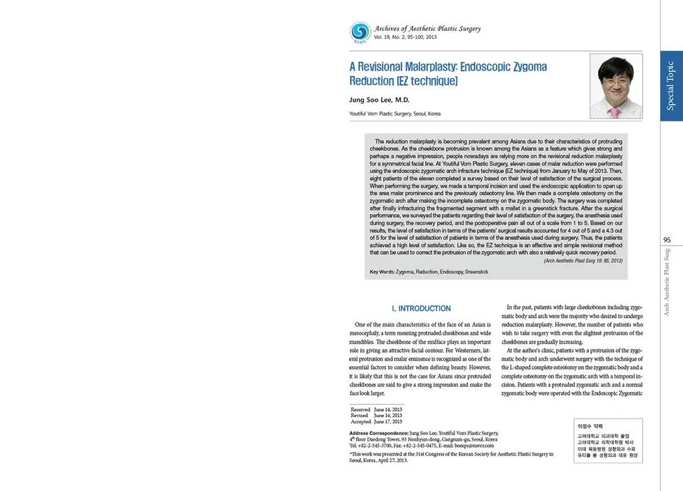 Application of the EZ technique in revision zygoma surgery — source material