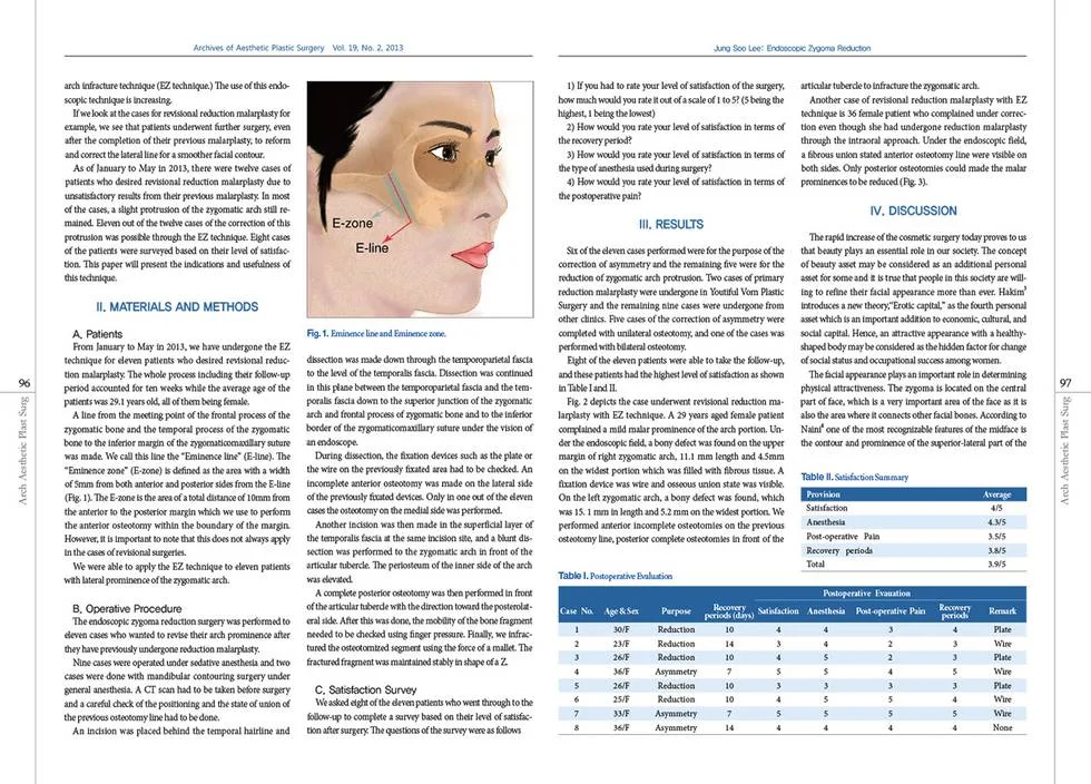 Application of the EZ technique in revision zygoma surgery — source material