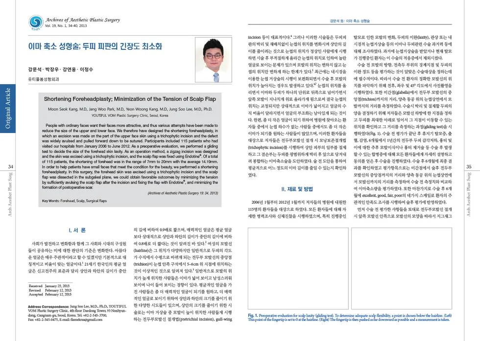 Forehead reduction surgery: minimizing scalp flap tension — source material