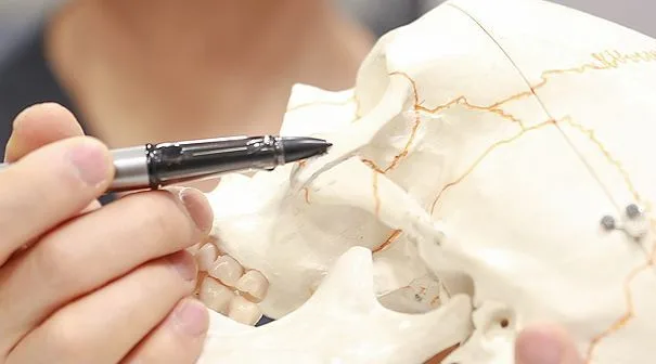 Marked area of the zygomatic arch