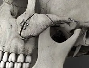 Reference image related to Dr. Jung Su Lee of UVOM Plastic Surgery