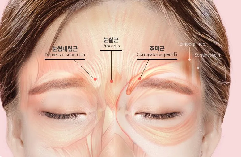 Eyebrow depressor muscles: depressor supercilii, procerus, and corrugator supercilii