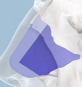 Location of septal cartilage