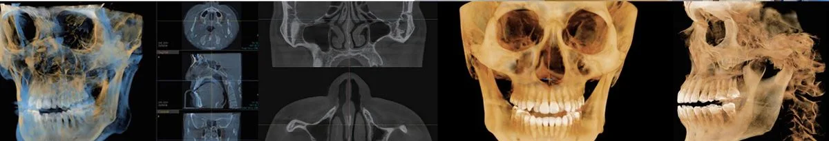 3D CT analysis screen