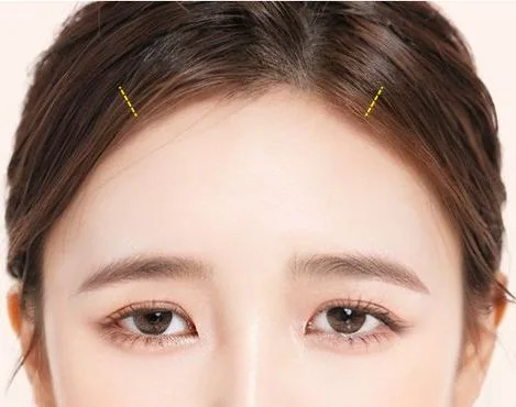 Image from materials related to Dr. Jung Su Lee, Chief Director of UVOM Plastic Surgery