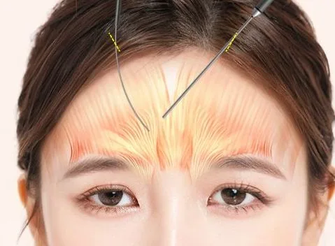 Image from materials related to Dr. Jung Su Lee, Chief Director of UVOM Plastic Surgery