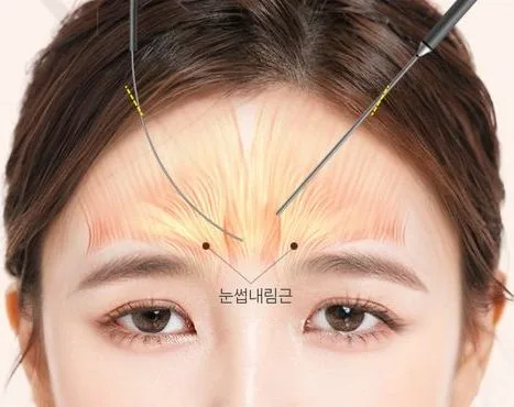 Image from materials related to Dr. Jung Su Lee, Chief Director of UVOM Plastic Surgery