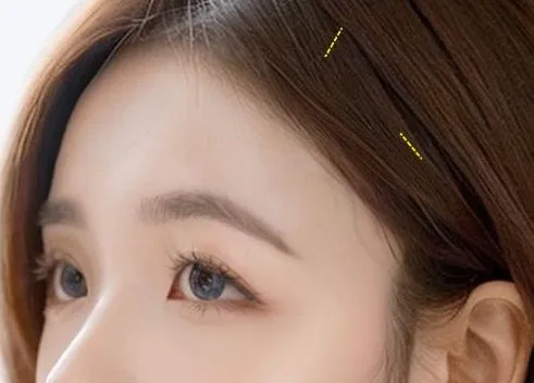 Image from materials related to Dr. Jung Su Lee, Chief Director of UVOM Plastic Surgery