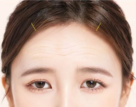 Image from materials related to Dr. Jung Su Lee, Chief Director of UVOM Plastic Surgery