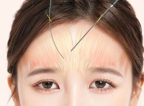 Image from materials related to Dr. Jung Su Lee, Chief Director of UVOM Plastic Surgery