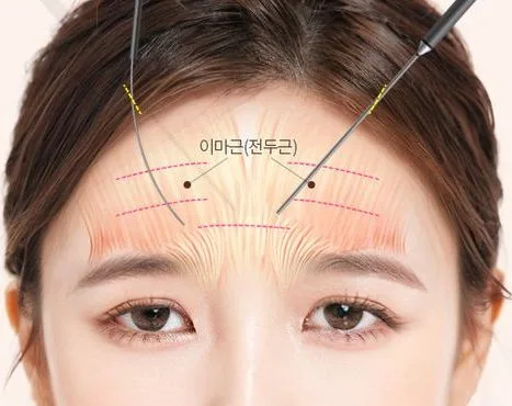 Image from materials related to Dr. Jung Su Lee, Chief Director of UVOM Plastic Surgery