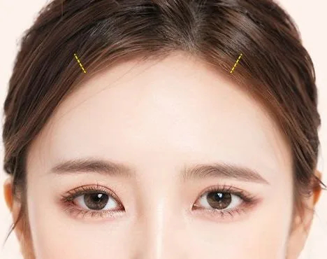 Image from materials related to Dr. Jung Su Lee, Chief Director of UVOM Plastic Surgery