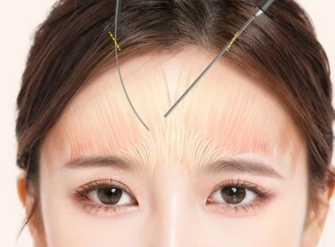Image from materials related to Dr. Jung Su Lee, Chief Director of UVOM Plastic Surgery
