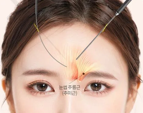 Image from materials related to Dr. Jung Su Lee, Chief Director of UVOM Plastic Surgery