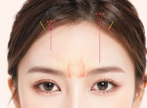 Image from materials related to Dr. Jung Su Lee, Chief Director of UVOM Plastic Surgery